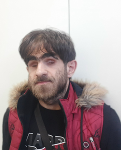 Disabled refugee’s courage shines through