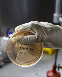 Superbugs pose a threat to refugee communities – report